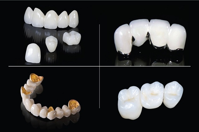 Răng sứ hiện nay được làm từ nhiều loại vật liệu cao cấp khác nhau