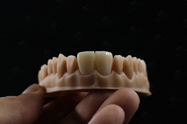 Răng toàn sứ được làm từ chất liệu cao cấp, bền màu, sử dụng dài lâu