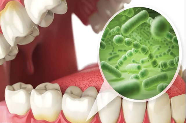 Dán sứ không đúng kỹ thuật có thể dẫn tới nhiều bệnh lý răng miệng nguy hiểm